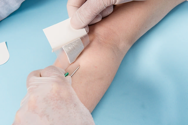 SOVAN® – Högabsorberande hemostatisk pad 15x5 cm Ø2,6 cm, 2 styck/pack