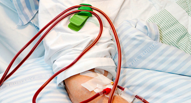 HED clip - dialyseslangeholder 50 stk./pk.